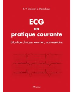 ECG en pratique courante - Situation clinique, interprétation, décision